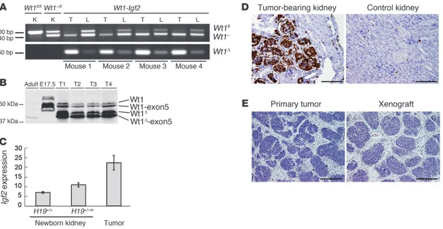 Figure 2Wt1-Igf2 mouse tumors are clonal, hyperproliferative, and malignant. (A) PCR detection of Wt1fl and Wt1Δ alleles in liver (L), and predominance 