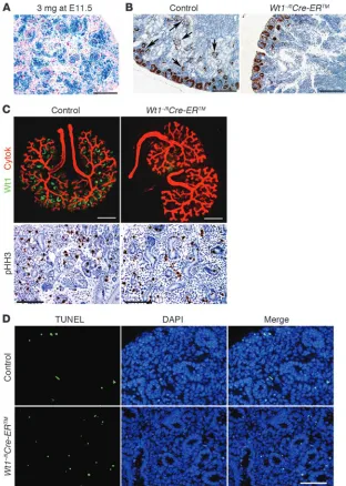 Figure 3Wt1 ablation at approximately E13 results in a 