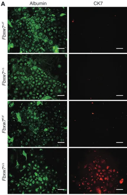 Figure 7Skewed differentiation of hepatic stem cells from Fbxw7-deficient mice. (A) Primary cultured liver cells of the indicated genotypes were subjected to immunofluorescence staining with antibodies to albumin or to CK7