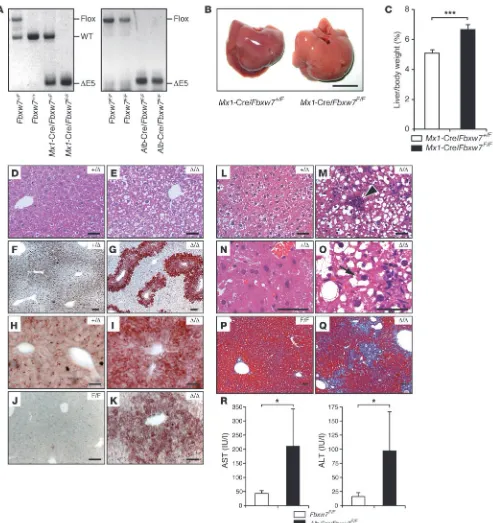 Figure 1Development of NASH-like liver disease as a result of Fbxw7 deletion. (A) Genomic PCR analysis from the mouse liver of the indicated geno-types