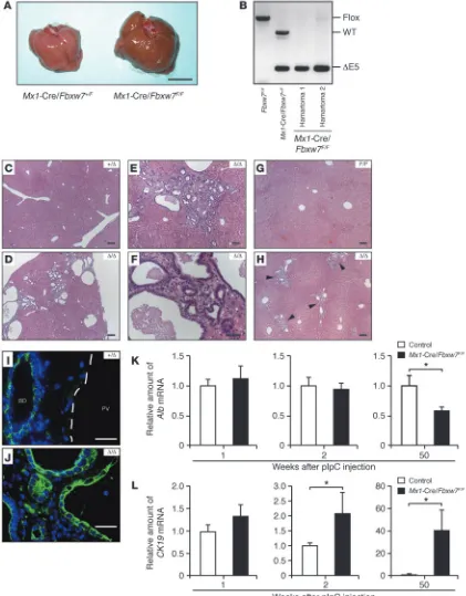 Figure 5Hamartoma development as a result of long-term ablation of Fbxw7 in the liver