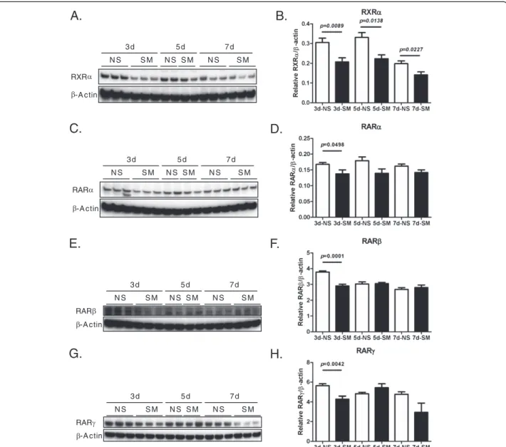 Figure 3 Western blot analyses for retinoid X receptor alpha (RXRalpha), retinoic acid receptor alpha (RARalpha), retinoic acid receptor beta (RARbeta), and retinoic acid receptor gamma (RARgamma) expression in distal lung tissue from mice with and without