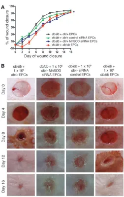 Figure 6MnSOD deficiency impedes EPC-mediated wound healing in nor-