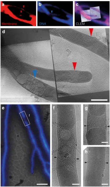 Figure 4 | Vancomycin-BODIPY staining shows positions of cell wall restructuring. Cryo-CLEM on vegetative hyphae of S