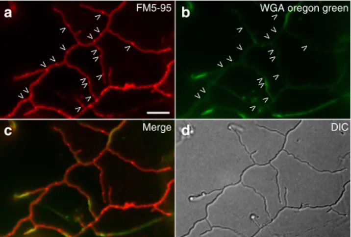 Figure 5 | Membrane and cell wall localization in an S. coelicolor ftsZ-deletion strain