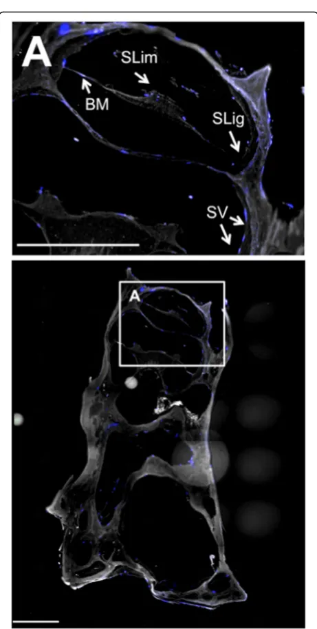 Fig. 5 Myosin VIIA identification in hWJCs perfused throughdecellularized cochleae. Human Wharton’s jelly cells (hWJCs) werestained with DAPI (blue) to identify cell nuclei, while the motor protein,Myosin VIIA (MYO7A) was identified via immunohistochemical