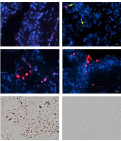 Figure 1 Expression of gamma-H2AX detected by immunofluorescence or (middle left) or gOLD 4 (middle right) representative emphysematous lungs