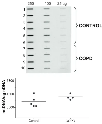 Figure 5 Top: quantitative Southern blot analysis of alkali-labile lesions in a 10.3 Kb tissue samples from patients with COPD