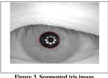 Figure 2 shows the result before and after applying the preprocessing technique in iris image