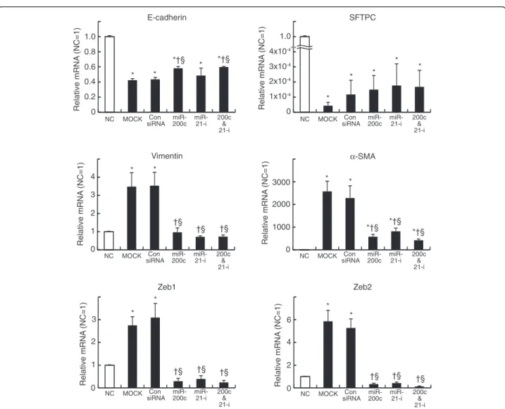 Figure 6 miR-21 attenuates TGF- β-induced epithelial-mesenchymal transition in mouse alveolar type II cells