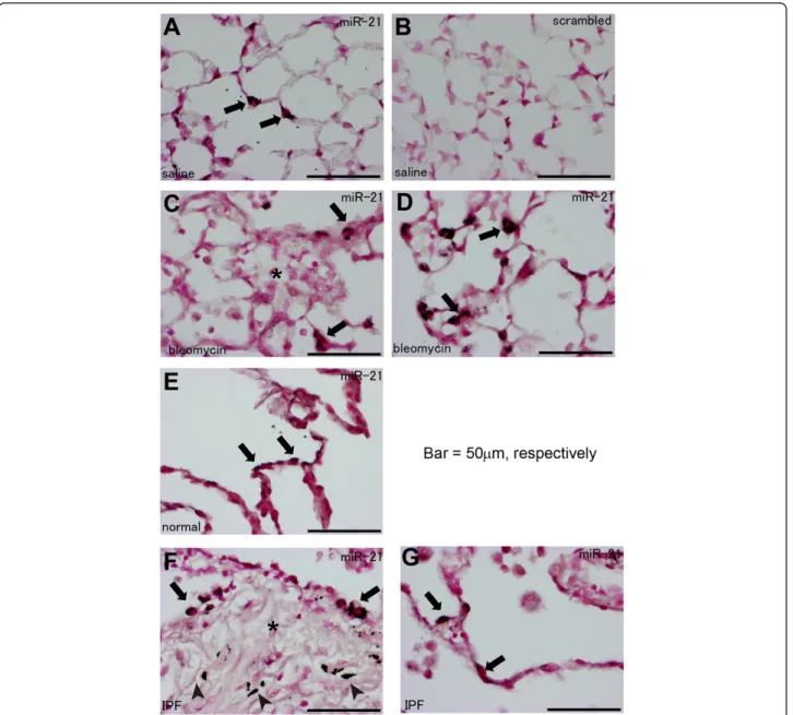 Figure 3 Histological analyses for miR-21 expression in mouse and human lung tissues using in situ hybridization