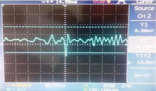 Fig -12: Normal EOG waveform 