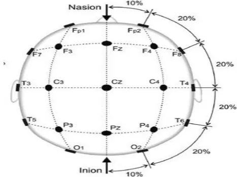 Fig -2:  A Typical EEG based BCI  