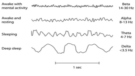 FIG -4: Brain Waves 