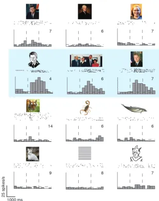 Figure 5Example of a neurophysiological recording 