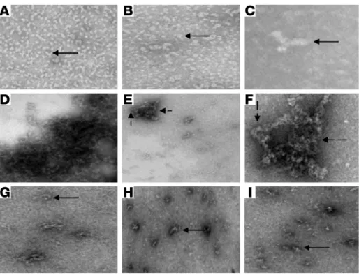 Figure 6Analysis by electron microscopy of individual or mixed prepara-
