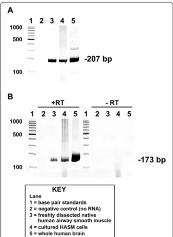 Figure 1 RT-PCR analysis of dopamine D 1 -like receptors in human airway smooth muscle