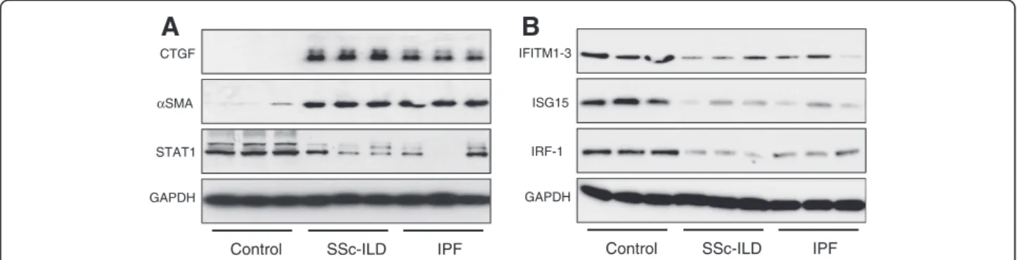 Figure 3 Western blot confirmation of microarray results. Protein expression levels of six significantly differently expressed genes selected from the microarray data were visualised by western blot in fibroblast samples independent to those used in the mi