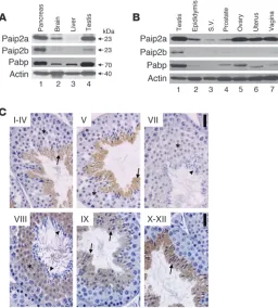 Figure 1Paip2a and Paip2b expression in mouse. (