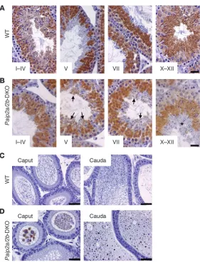 Figure 4Abnormal Pabp expression in late spermiogenesis in 