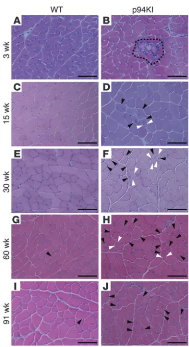 Figure 1MD phenotypes in p94KI mice. (