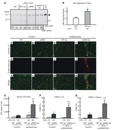 Figure 2Exercise-induced myofiber degeneration in p94KI. (Scale bars: 100 excise. (and p94KI-ex sacrificed 10 days after exercise were analyzed