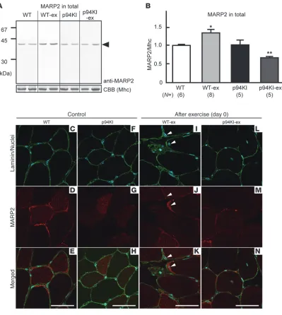 Figure 4Changes in MARP2 in WT and p94KI mice before and after exercise. (The total extract of TA muscles was subjected to Western blot analysis using an anti-MARP2 Ab (representative blots are shown; see Supplemen-tal Figure 7 for all the blots)
