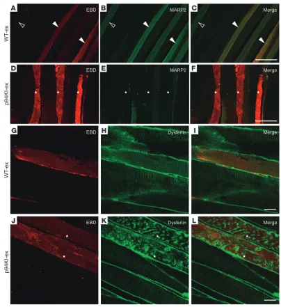 Figure 5EBD uptake in the myofibers of exercised WT and p94KI mice. EBD-injected WT and p94KI mice were subjected to downhill running and then 