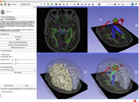 Fig. 2 Experimental visualization of brain tumor case of DTI