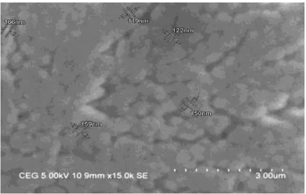 Fig no: 2. SEM images showing the shape and size of the particle size of the drug DLD