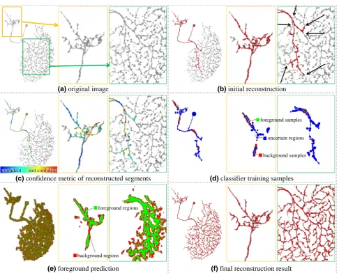 Fig. 1 Overview of SmartTracing method and the result for a singleimage. In each sub-ﬁgure, the global 3D view of images and theoverlapped reconstructions is shown on the left