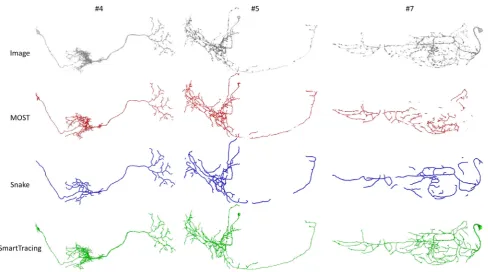 Fig. 6 Examples of performing SmartTracing iteratively. Recon-SmartTracing of case #7 shown in Fig.instruction shown in red tube is overlapped on the original image shown gray