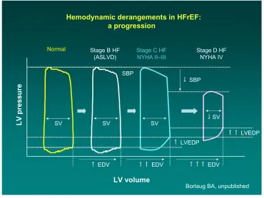 Figure 1 Progression of hemodynamic derangements in heart failure (Barry Borlaug, with permission).Abbreviations: ASLvD, asymptomatic systolic left ventricular dysfunction; eDv, end-diastolic volume; HF, heart failure; HFreF, heart failure with reduced ejection fraction; Lv, left ventricle; LveDP, left ventricular end diastolic pressure; NYHA, New York Heart Association; SBP, systolic blood pressure; Sv, stroke volume.