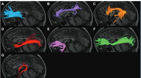 Figure 1 Superimposition of a DTT image of the left ATR on a sagittal T1-weighted image in HC