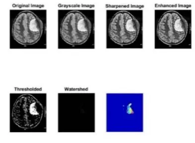 Figure 13. Output of Image 1 in parallel for Watershed  Segmentation 