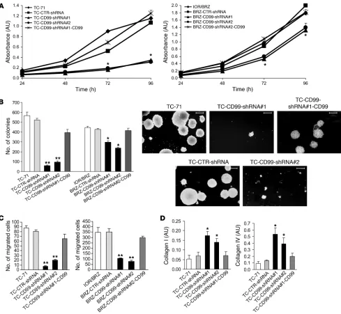Figure 2In vitro growth features of EWS cells silenced for CD99. (A) CD99-silenced cells showed reduced growth in monolayer conditions compared 