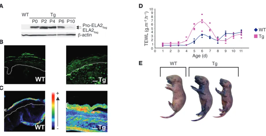 Figure 4Skin barrier defect is linked to ELA2flag expression and activity. (A) Immunodetection of ELA2flag (pro-form and active forms) in Tg-ELA2 epider-mal extracts