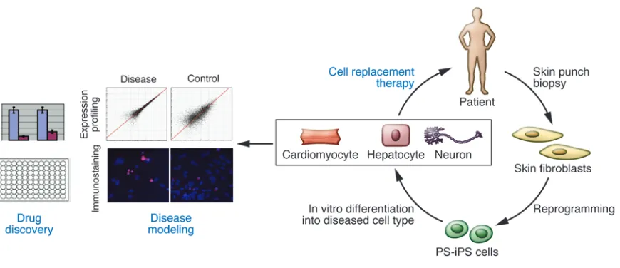 Figure 3Clinical relevance of iPS cells. iPS cell technology has exciting potential applications in disease modeling and drug discovery