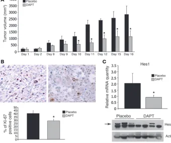 Figure 7Notch cleavage is insensitive to TORC1 inhibition in patient-derived cells. (A) Levels of the 110-kDa band representing the γ-secretase cleaved, active form of the Notch receptor, were decreased following treatment with the -secretase inhibitor DAPT as expected, while in rapamycin and 