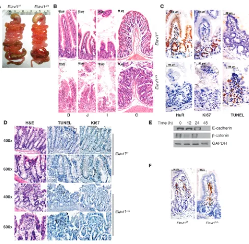 Figure 5Role of HuR in intestinal integrity and progenitor cell survival. (A) Abnormal appearance of the GI tract 4 days after deletion of Elavl1