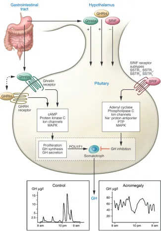 Figure 2Normal and disrupted GHRH–GH–IGF1 axis 