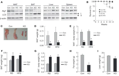 Figure 2ATG7F/F-aP2-Cre mice have decreased WAT and increased BAT mass. (A) Immunoblots of proteins isolated from the indicated tissues from control (Con) ATG7F/F and knockout ATG7F/F-aP2-Cre mice