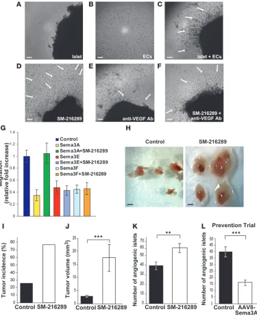 Figure 8Endogenous Sema3A regulates the angiogenic switch during tumor progression. Sema3A inhibition increased the angiogenic activity of islet puri-