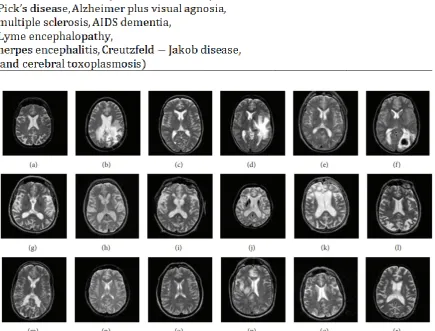 Fig. 6.  Sample test brain MRIs respectively. At the same time, the PSO-KSVM predicts a 