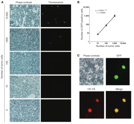Figure 3Selective visualization of human cancer cells by OBP-401. (A) Phase-contrast and fluorescent images of peripheral blood cells mixed with 