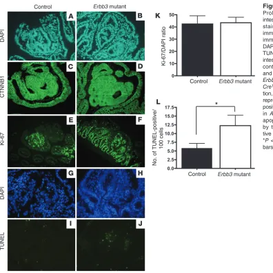 Figure 5Proliferation and apoptosis in intestinal tumors. (A and B) DAPI staining, (C and D) CTNNB1 immunostaining, (E and F) Ki-67 immunostaining, and (G and H) DAPI staining with (I and J) matched TUNEL staining of size-matched intestinal tumors from 3-m