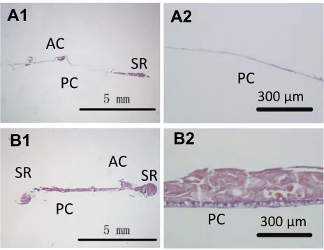 Figure 12 Soemmering’s ring (SR), peripheral PCO (PPCO) and central PCO(CPCO) scores of drug-eluting IOL ((HEP/CTDNP)5 multilayer modiﬁed) andcontrol pristine IOL (*P<0.05).