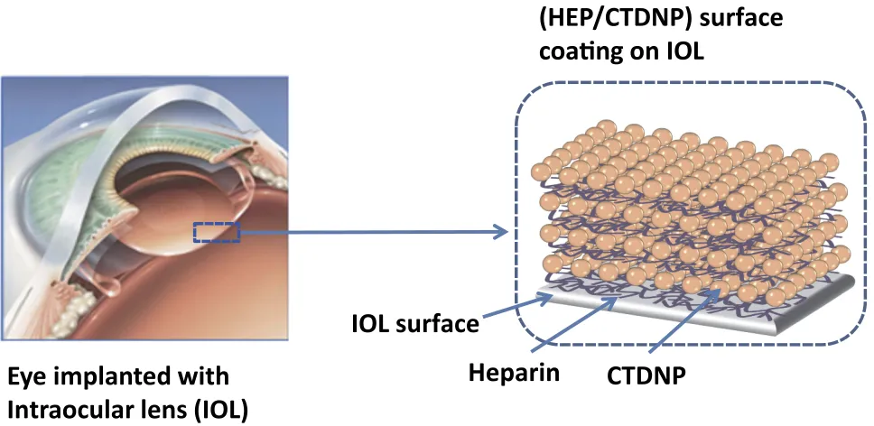 Figure 1 Schematic illustration of drug-eluting hydrophilic coating-modiﬁed IOL fabricated via layer-by-layer deposition of heparin and drug-loaded chitosan nanoparticles.