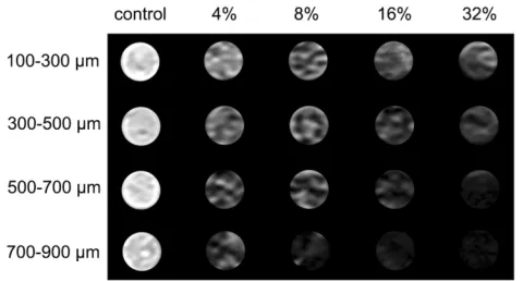 Figure 11 The typical T2-weighted MR images of the same mouse before, imme-diately after, at 14 d and 28 d after subcutaneous injection of FNMs into the back(A) and the quantiﬁcational analysis of signal-to-noise changes at the correspondingtime points after the injection into three mice (B).Note: The arrows denoted the dark signal area induced by FNMs.Abbreviations: MR, magnetic resonance; FNMs, magnetic polymer microspheres;△SNR, the change of signal-to-noise ratio.