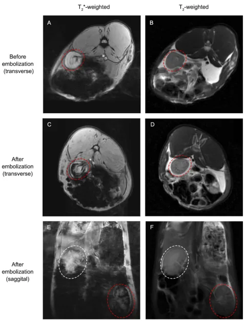 Table 3 △SNR Of The Rabbits Embolized With FNMs InTransverse And Sagittal Images With T2*- And T2-WeightedSequences (n=2)